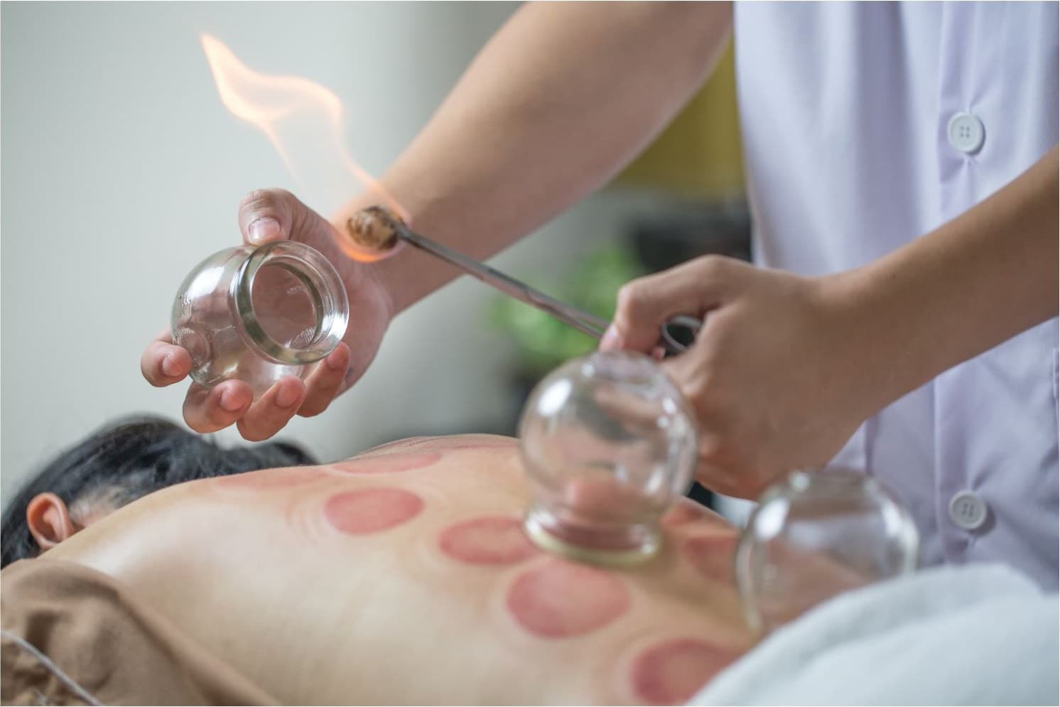 Treatment room at Chinese Wellness Center